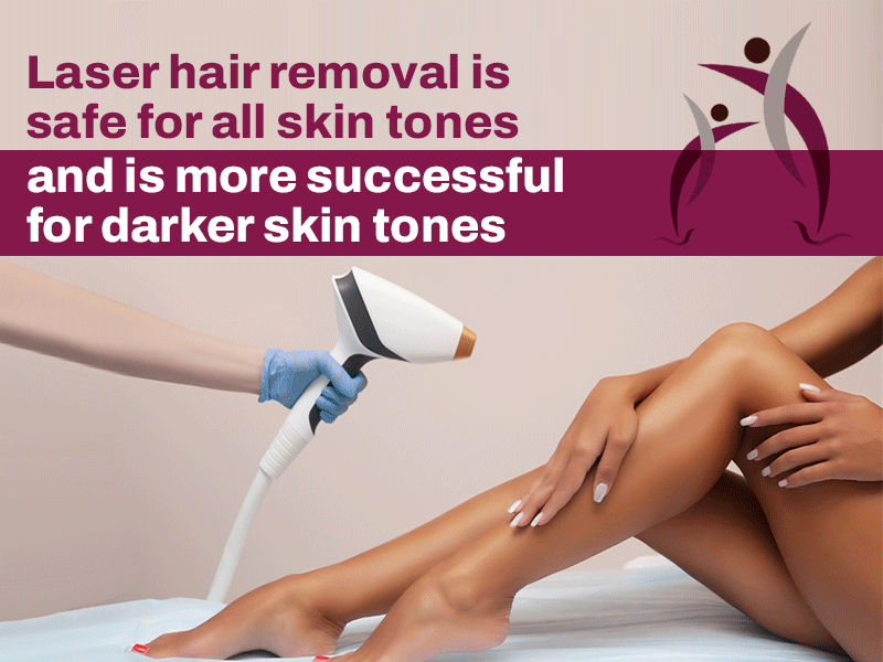 Is Laser Hair Removal a Permanent Solution? - Listen from the Dermatologist 2 Laser Hair Removal Is Safe For All Skin Tones