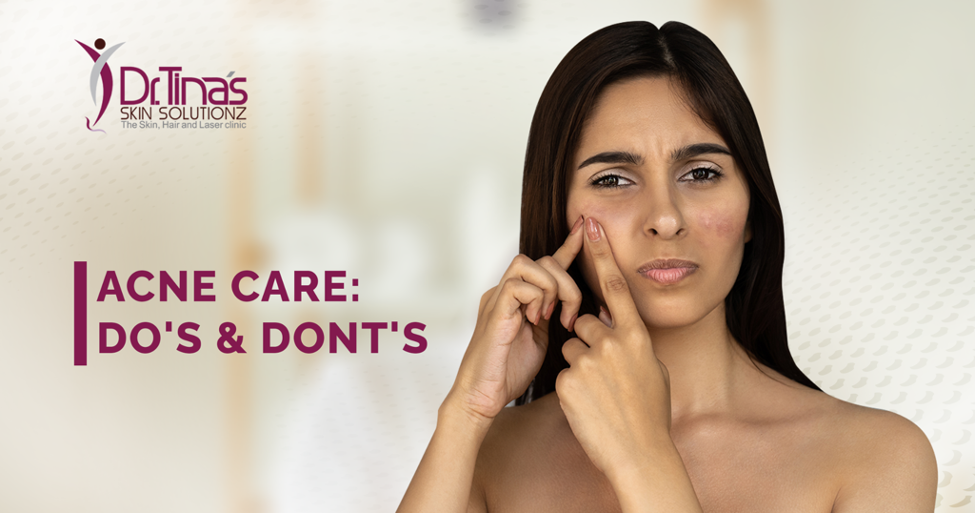 What are Some Do's and Don'ts for Acne-Prone Skin? 1 Acne Care Tip From Dr Tina Skin Solutionz