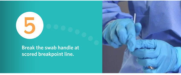 Nasopharyngeal(NP) Sample Collection Flocked Swab for the Flu