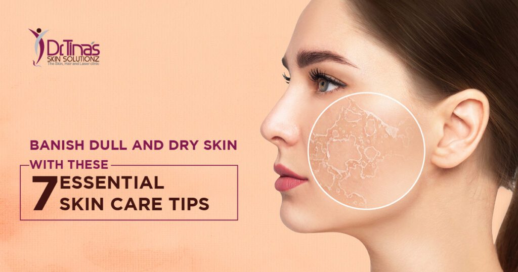 Banish Dull and Dry Skin with these 7 Essential Skin Care Tips 1 dull and dry skin