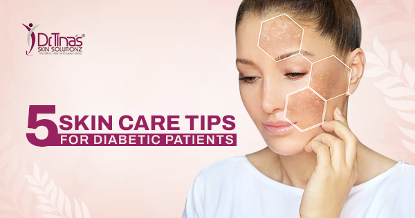 5 Skin Care Tips for Diabetic Patients 1 5 Skin Care Tips for Diabetic Patients