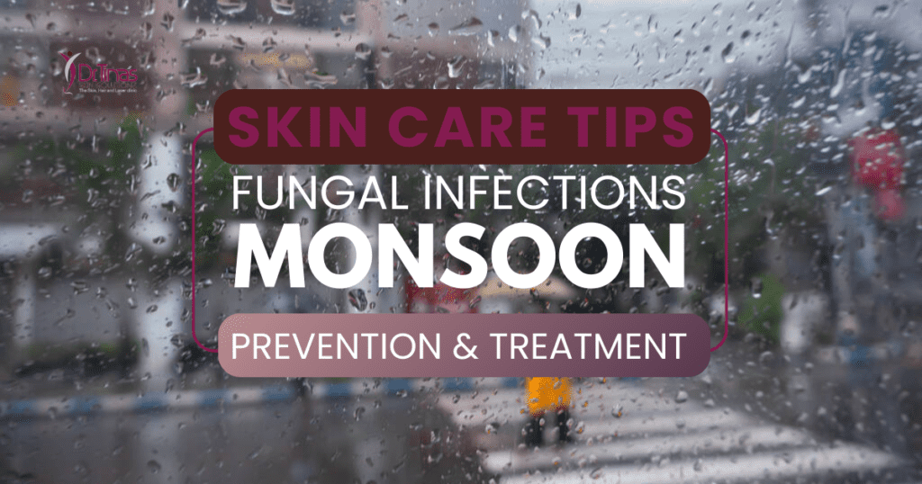 Prevention and Treatment of Fungal Infections During the Monsoon 1 Monsoon Fungal Infections- Prevention & Treatment