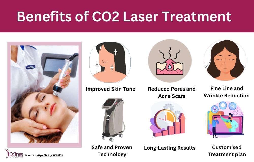 Understanding the Benefits of Fractional CO2 Laser Treatment for Skin Whitening 4 co2 laser treatment