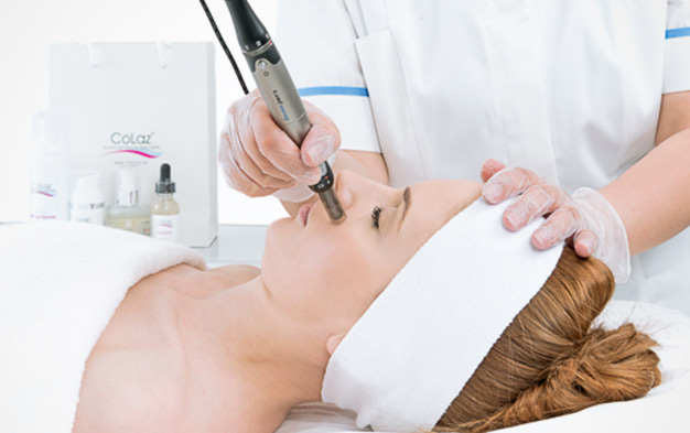 Laser Therapy for Age Spots