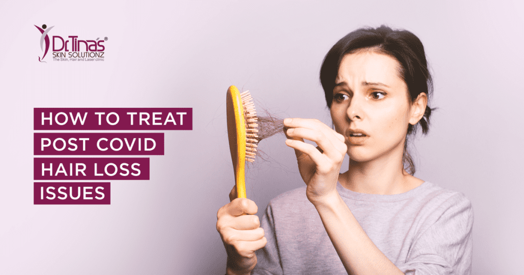 How to Treat Post Covid Hair Loss Issues? 1 How to Treat Post Covid Hair Loss Issues