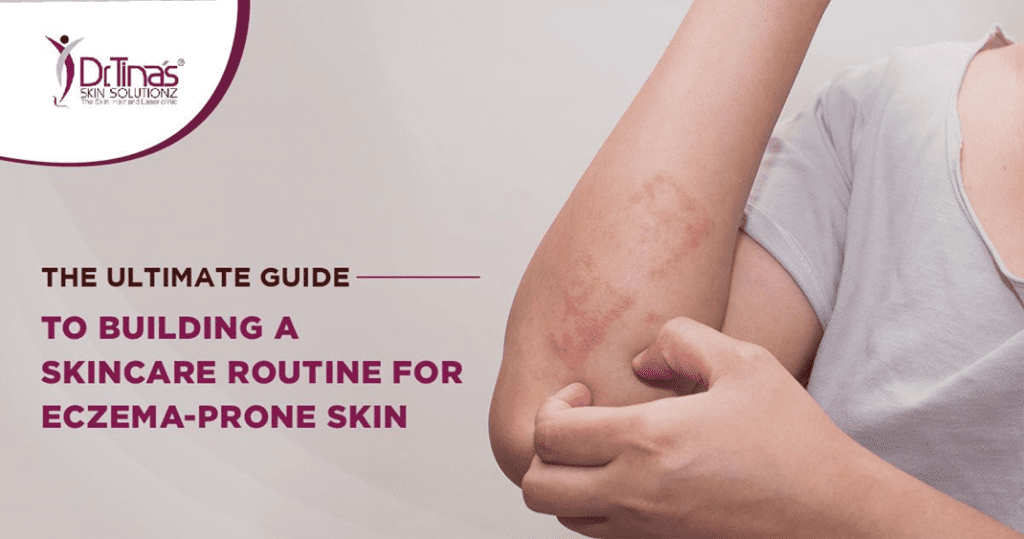 The Ultimate Guide to Building a Skincare Routine for Eczema-Prone Skin 1