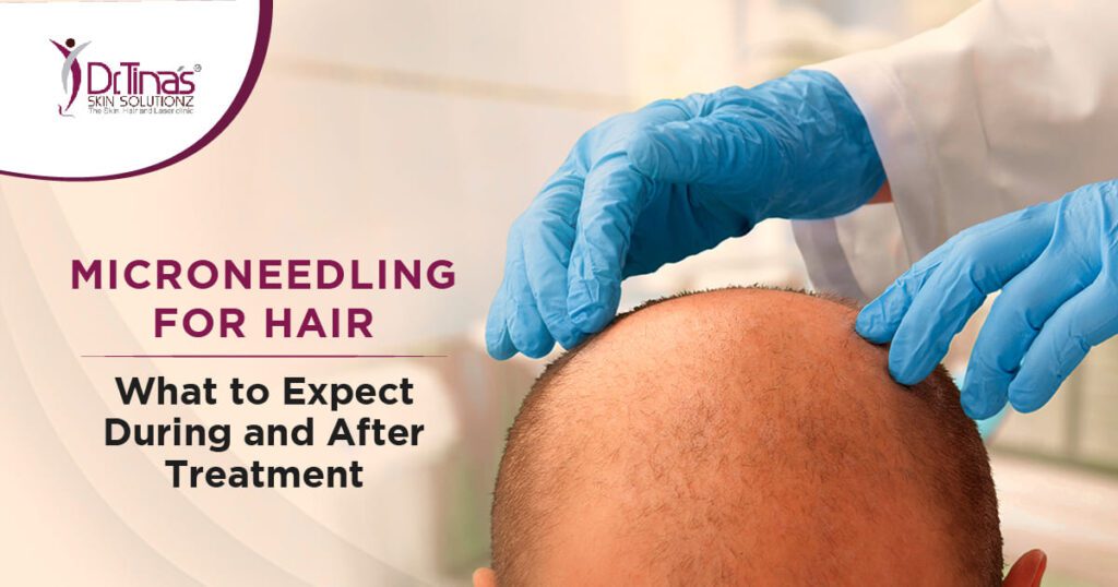 Microneedling for Hair: What to Expect During and After Treatment 1 Dr. tina Blog 01 01 3