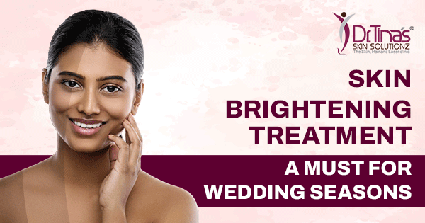 Skin Brightening Treatment- A Must for Wedding Seasons 1 skin brightening treatment- must for wedding seasons