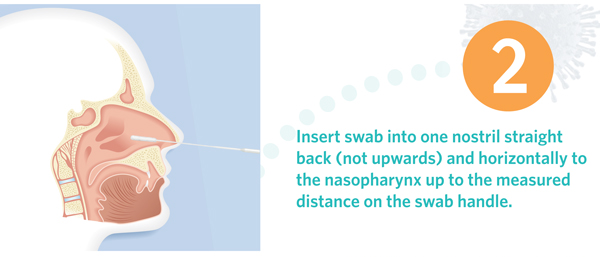 Nasopharyngeal(NP) Sample Collection Flocked Swab for the Flu