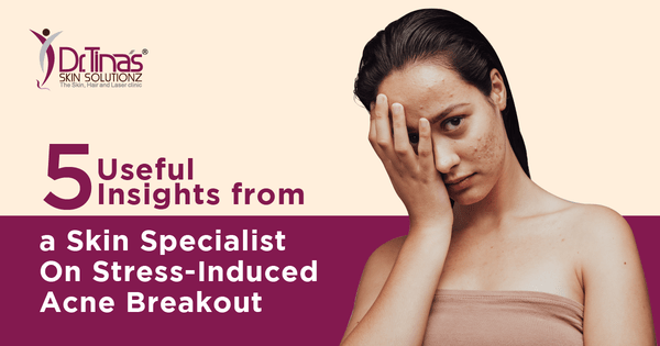 5 Useful Insights from a Skin Specialist on Stress-Induced Acne Breakout 1 % Useful insights from a dermatologist for stress induced acne