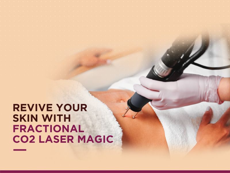 Understanding the Benefits of Fractional CO2 Laser Treatment for Skin Whitening 2 Revive your skin with fractional co2 laser treatment