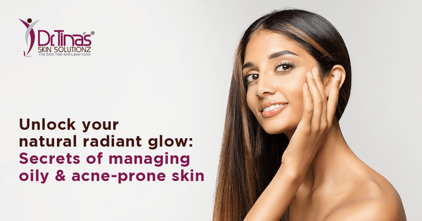 How to Get Rid of Oily Skin? 5 Tips For Managing Oily and Acne -Prone Skin 1 Taming oily acne prone skin