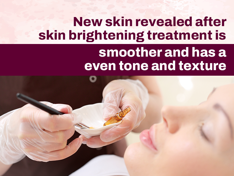 Skin Brightening Treatment- A Must for Wedding Seasons 2 Chemical peel leaves a smooth and even tone texture