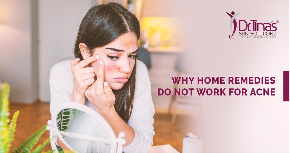 Why Home Remedies may not Work for Acne? 1 Why Home Remedies may not Work for Acne - Skin Solutionz