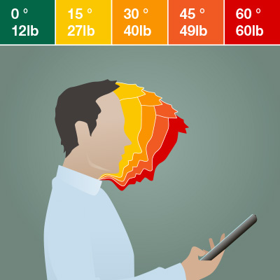 An illustration showing the strain of poor posture