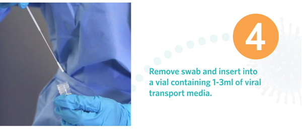 Nasopharyngeal(NP) Sample Collection Flocked Swab for the Flu