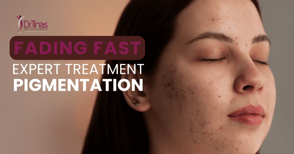 Fading Fast: Expert Pigmentation Treatment 1 Expert Pigmentation Treatment