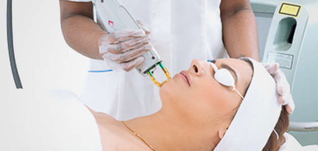 YAG Laser
