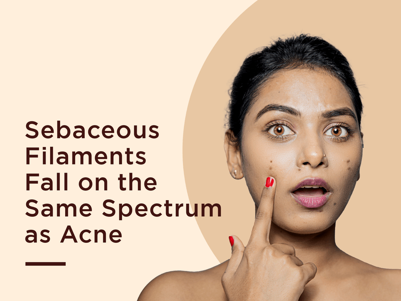 The Truth About Tiny Black Dots on Your Nose and How to Treat Them 2 Sebaceous Filaments fall on the same spectrum as acne