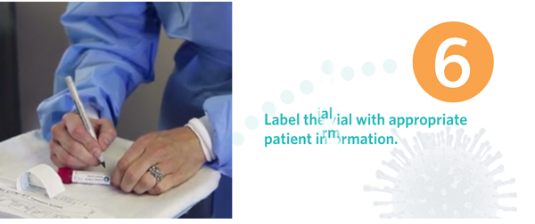 Nasopharyngeal(NP) Sample Collection Flocked Swab for the Flu