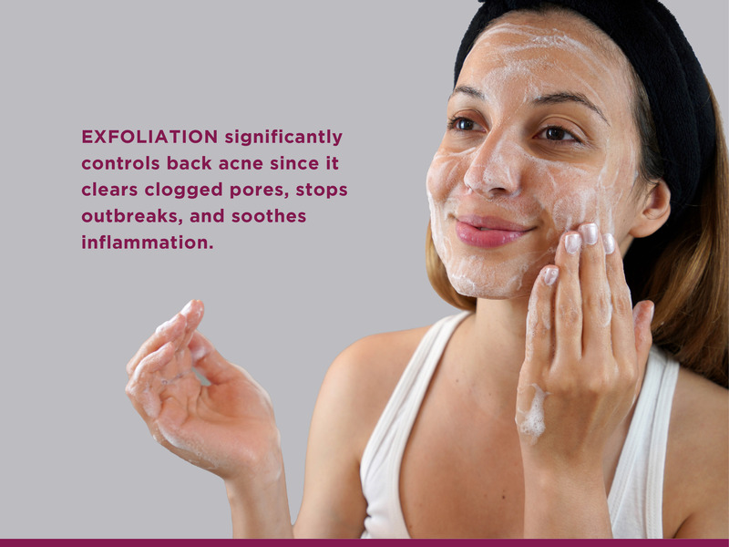 Say Goodbye to Back Acne Scars: Effective Strategies for Treatment 4 Exfoliation controls back acne