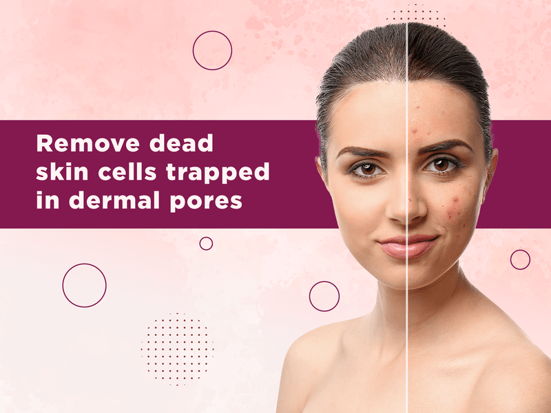 How Medifacial Can Help Your Skin Glow? 2 Medifacial scrapes off dead skin cells