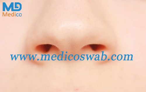 Nasal swab could help diagnose lung cancer
