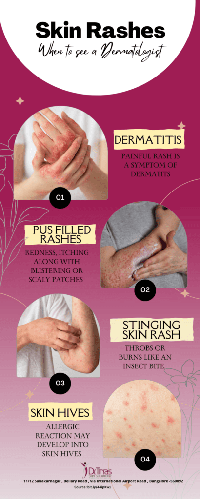 When to See a Dermatologist for Your Summer Skin Rashes 4 types of skin rashes