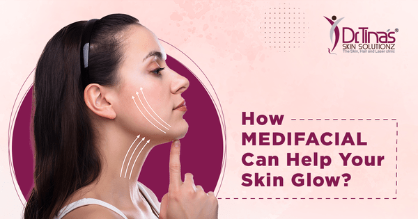 How Medifacial Can Help Your Skin Glow? 1 How Medifacials Helps with Skin Glow