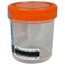 Urine Sample Cups