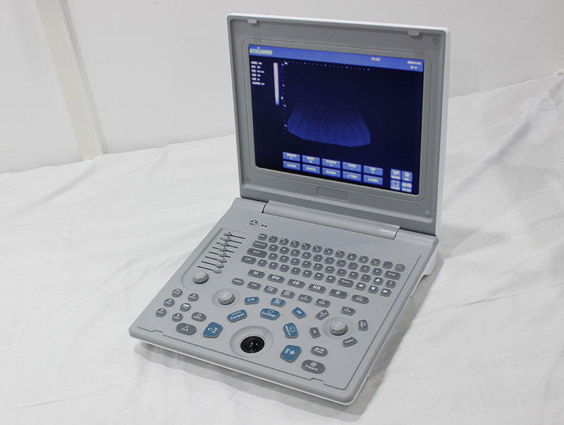 labtop ultrasound