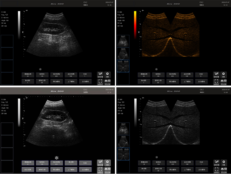 black and white ultrasound