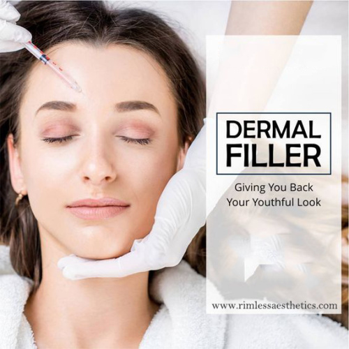 What are dermal fillers?