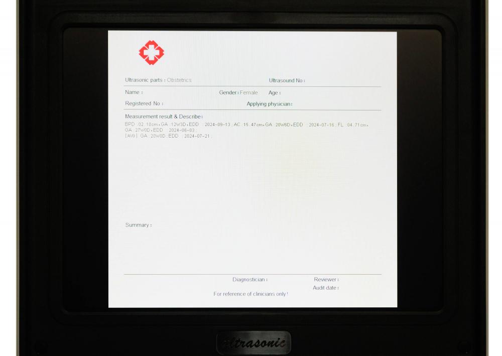 Ультрагукавы экран ноўтбука 19 Laptop Ultrasound Screen 19