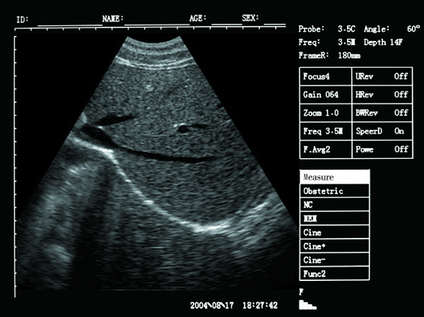 animal ultrasound