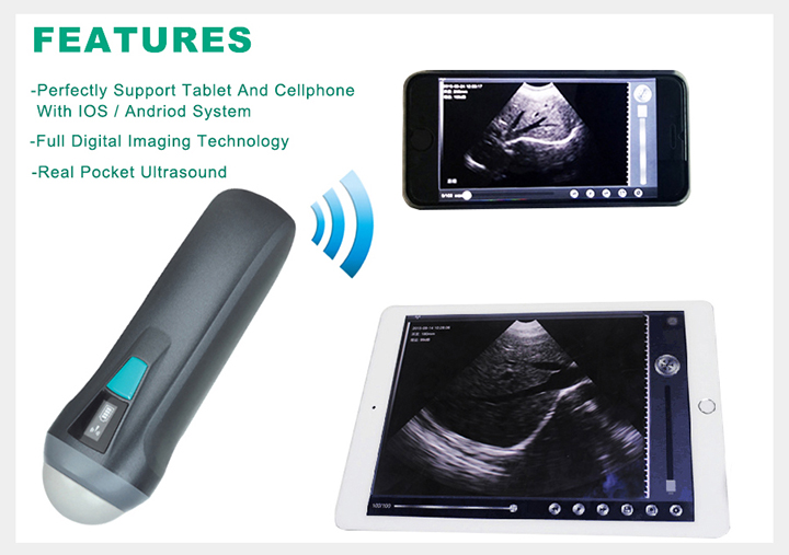 Veterinary Handheld Ultrasound Scanner