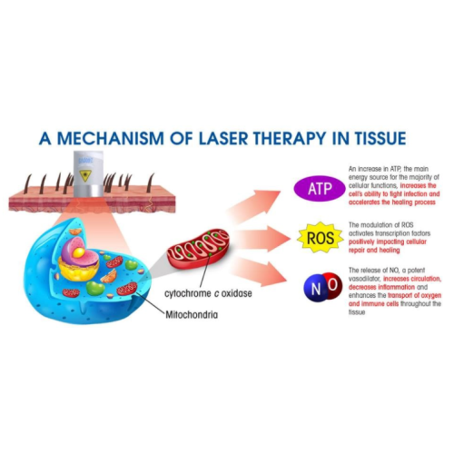 Qual é a terapia a laser de baixo nível?