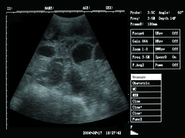 vet ultrasound scanner