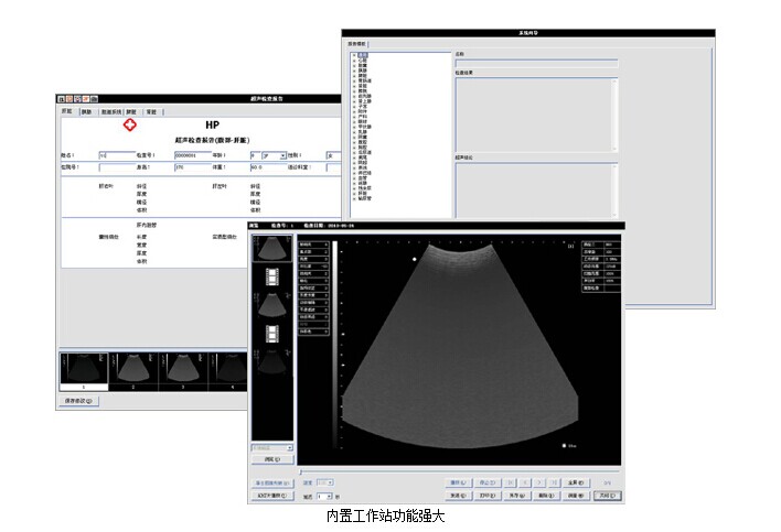 Ultrasound Box Ultrasound Scanner