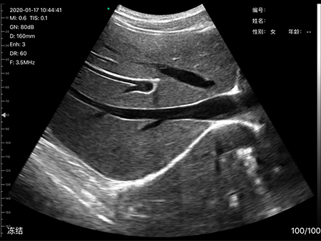 Wifi Ultrasound Wireless 