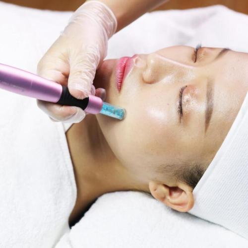 Precaustions and results for derma roller treatment