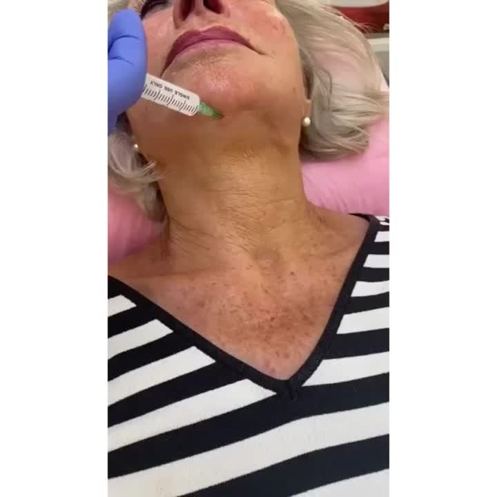 neck injection filler