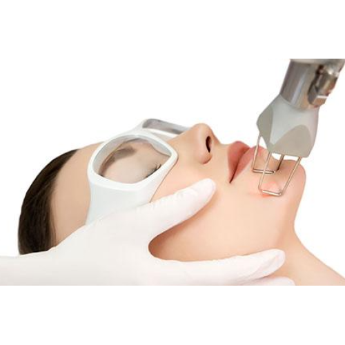 What is the Fractional CO2 Laser Used For? | Choicy Beauty- a beauty training academic  