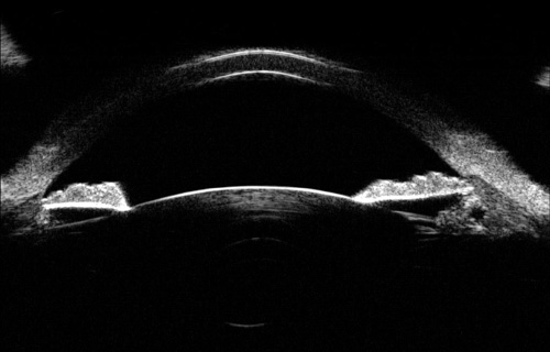 Ultrasound Biomicroscopy Microscope machine