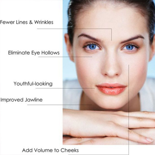 INJECTABLE FILLER