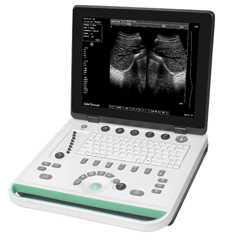 portable ultrasound