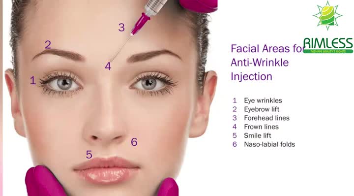 PLLA Dermal Filler for facial treatment