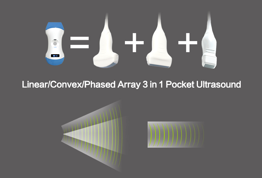 Wifi Ultrasound Wireless Ultrasound Scanner