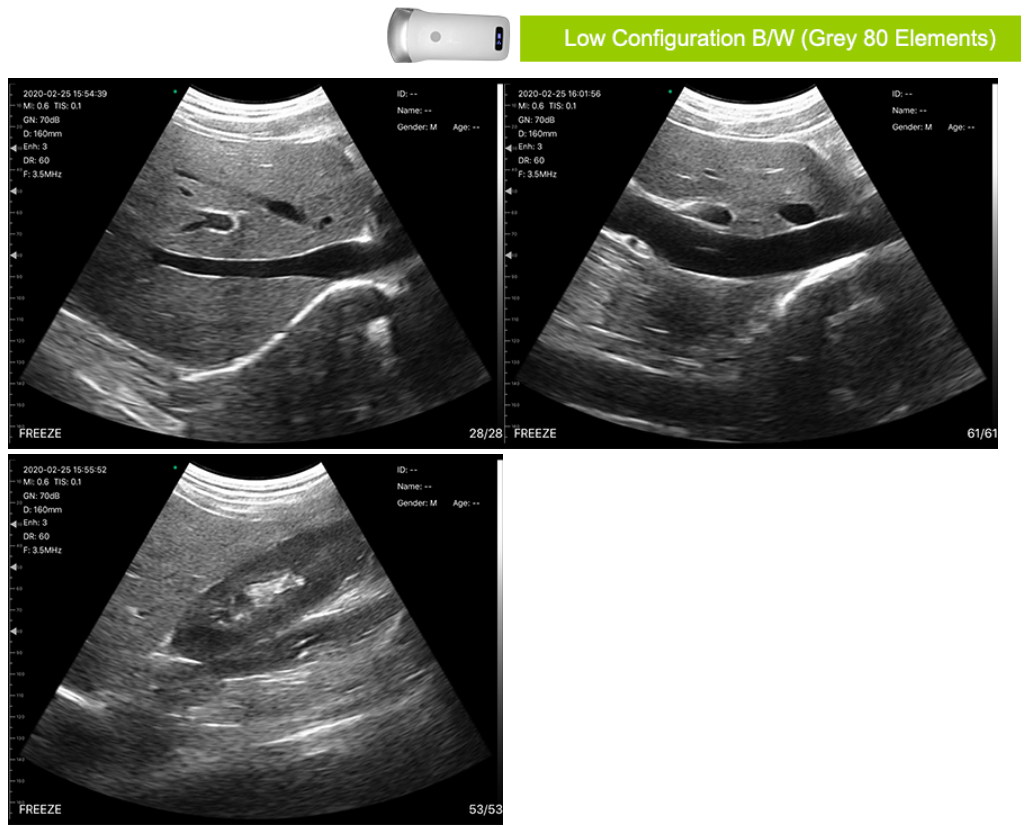 Portable Ultrasound scanner