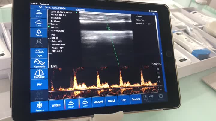 Uprobe-L6C PW-Funktion